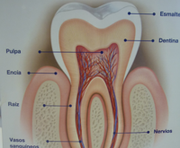 endodoncias-img1
